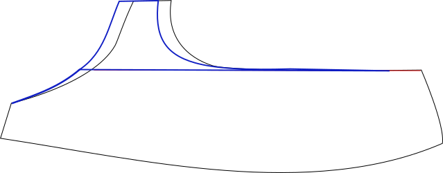 oberes Cup Traeger nach aussen verschoben Uebergang